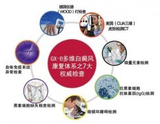 白癜风治疗用什么方法好