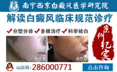 南宁白癜风哪里口碑比较好