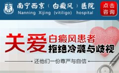 白癜风复发是不是更倾向于男性？